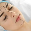 Qualifications of the Top 10 Beverly Hills Plastic Surgeons