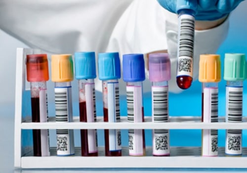 Do Marketing Companies Drug Test?